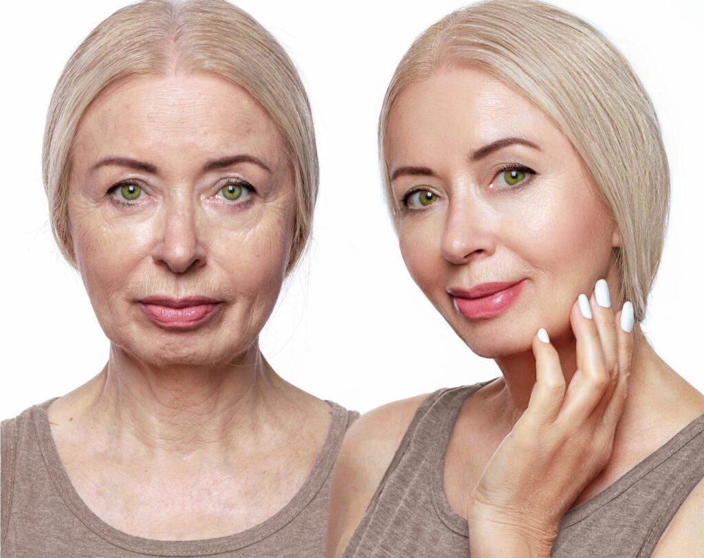 Anti-Aging Strategies and Techniques